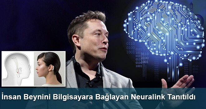 İnsan Beynini Bilgisayara Bağlayan Neuralink Tanıtıldı